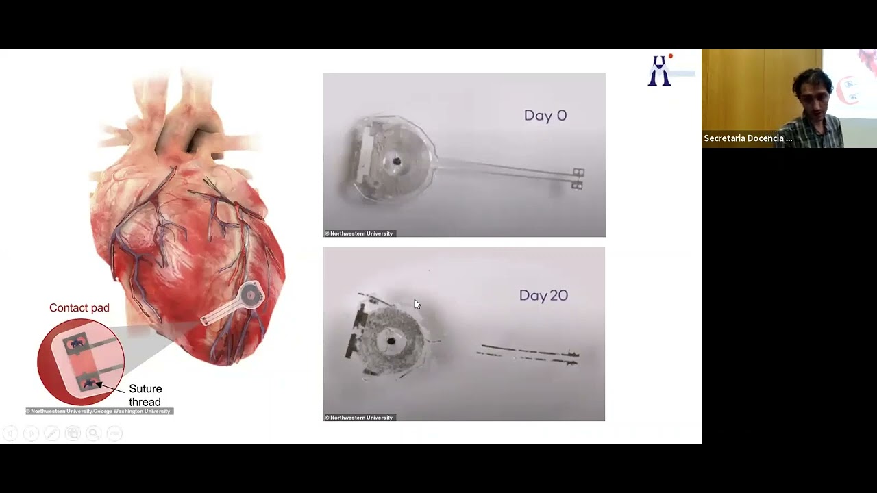 Actualización en las indicaciones y manejo de Marcapasos y DAI