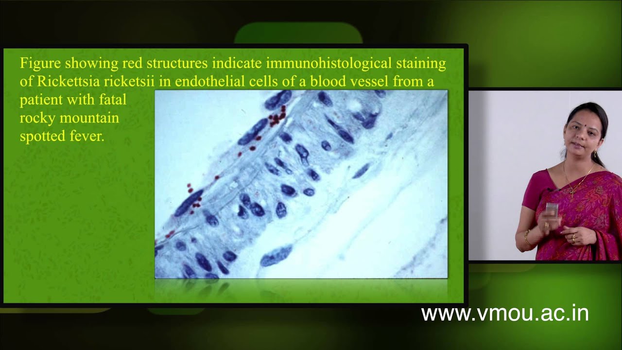 GRAM NEGATIVE BACTERIA-Rickettsia & Chlamydia
