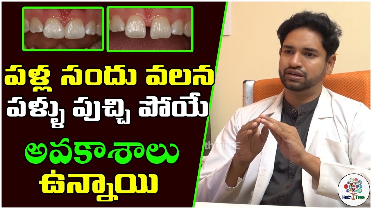 Diastema Problems and Rectifications || Dr. Shreeikanth  || Health Tree