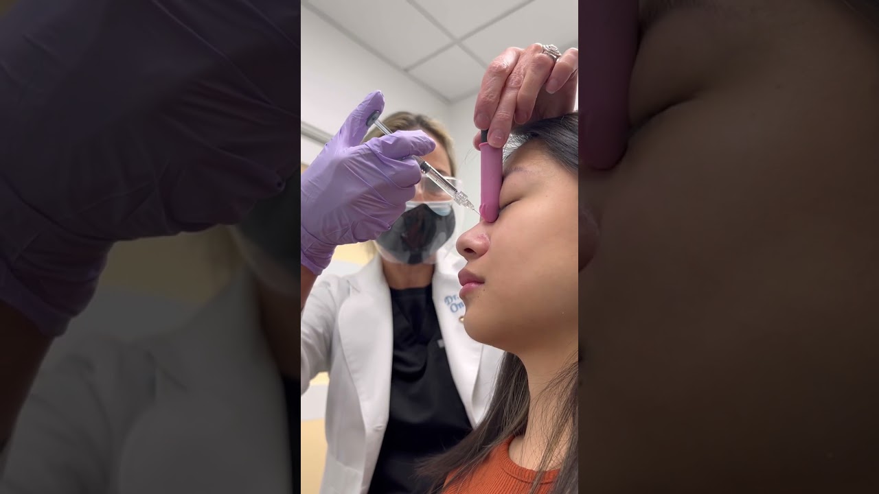 Nose & Chin Filler Before & After: Incredible Transformation