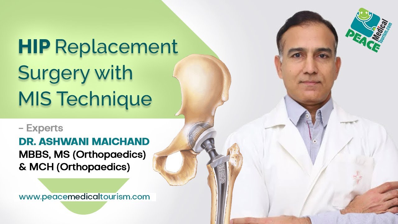 HIP REPLACEMENT SURGERY IN INDIA BY MIS TECHNIQUES  - DR ASHWANI MAICHANDA