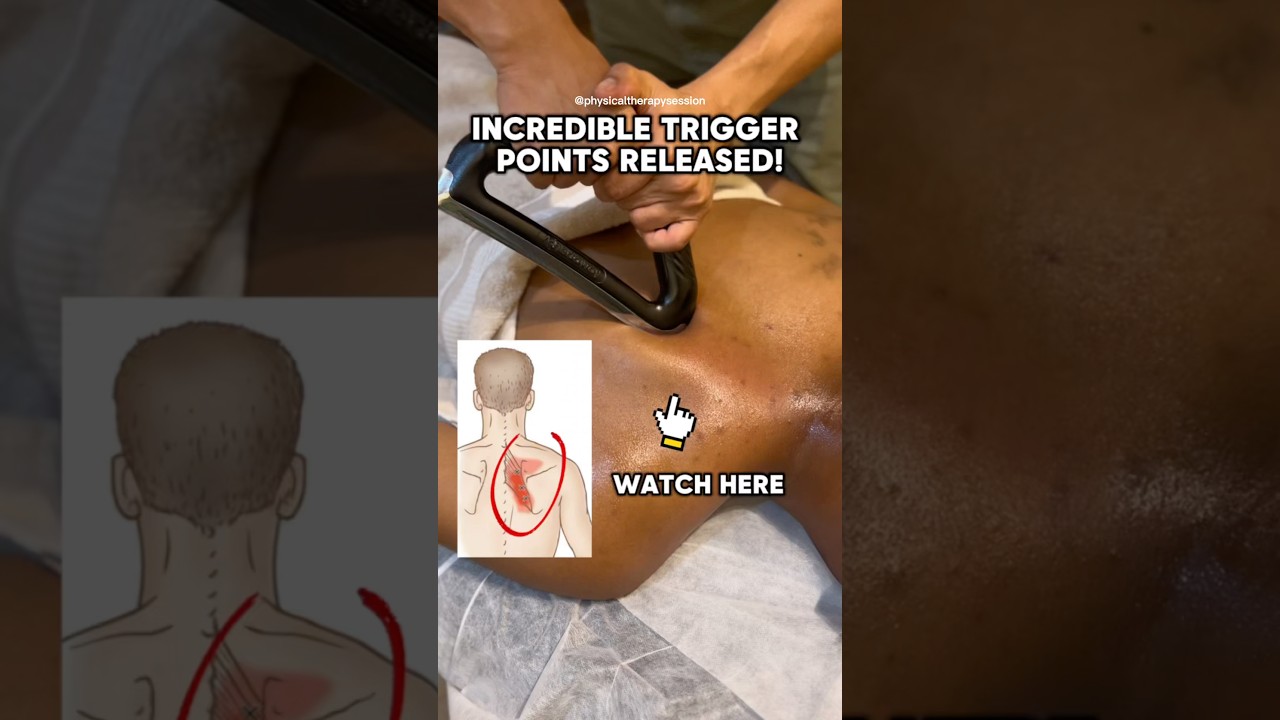 Watch that trigger points released!! #rhomboids #backpain #physicaltherapy