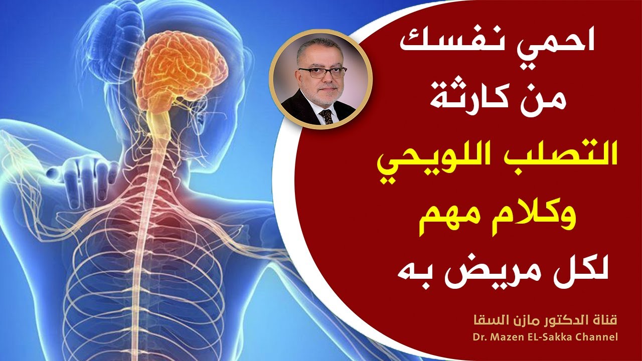 حتى لا تصاب بكارثة التصلب اللويحي | أعراضه وأسبابه وعلاجه الأفضل | لكل من يعاني من التصلب اللويحي