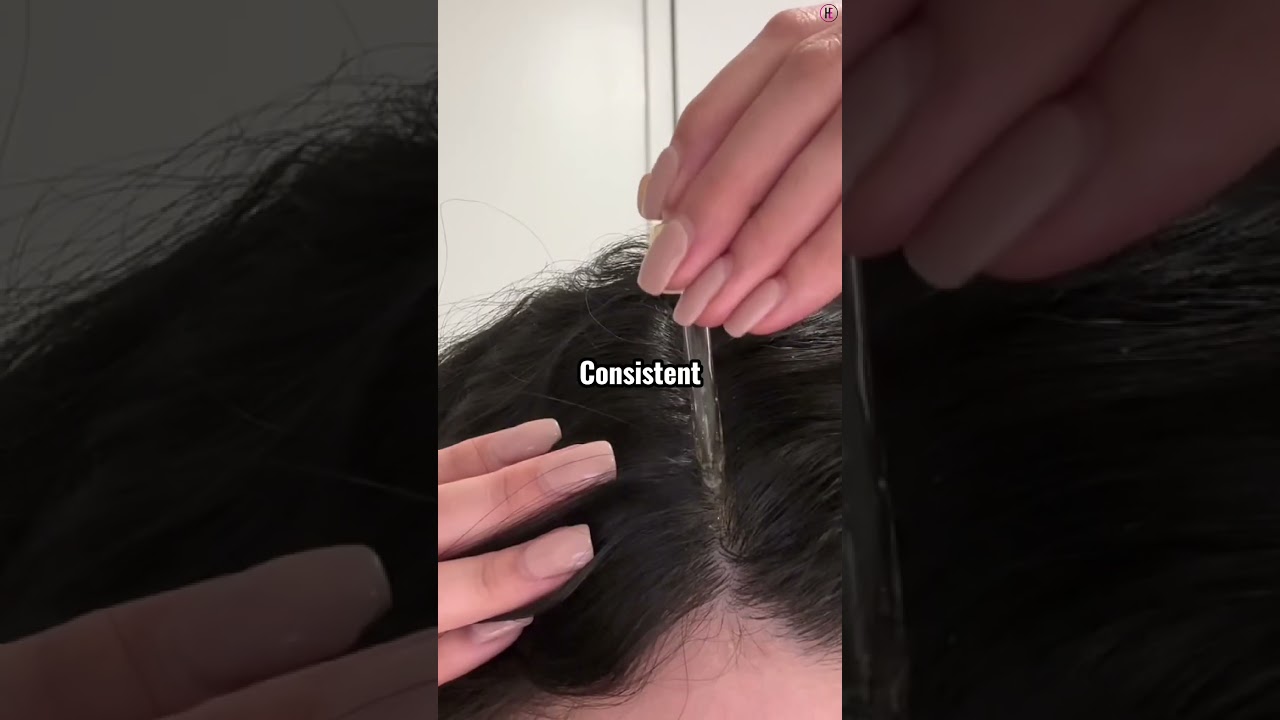 Hair shedding on Minoxidil? Don&rsquo;t panic&mdash;this means it&rsquo;s working! Watch till the end! #HairGrowth