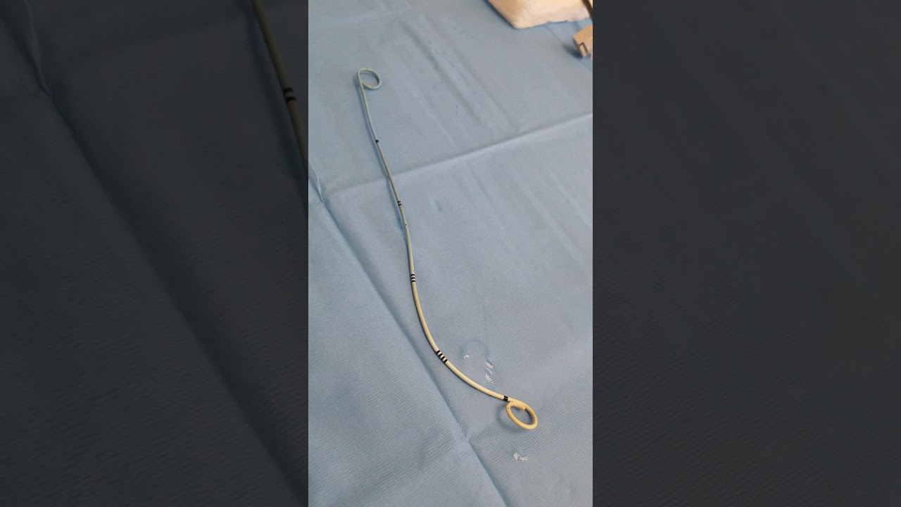 Ureteral Stent Removal part 3 of 3