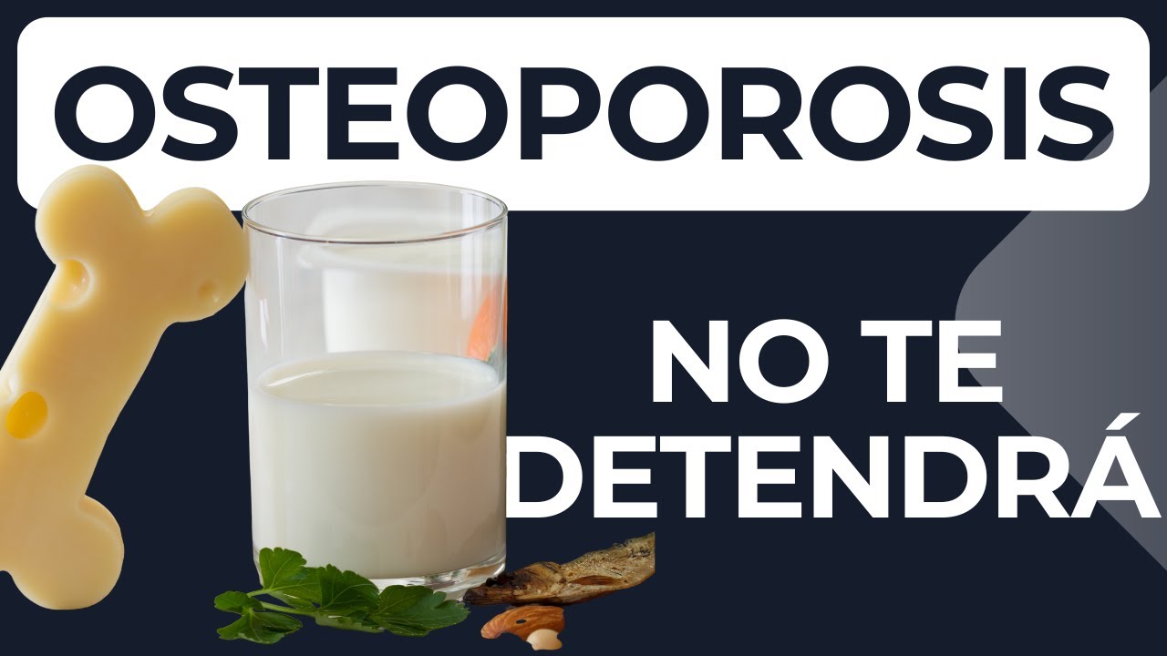 OSTEOPOROSIS: ¿Qué COMER para HUESOS Fuertes?