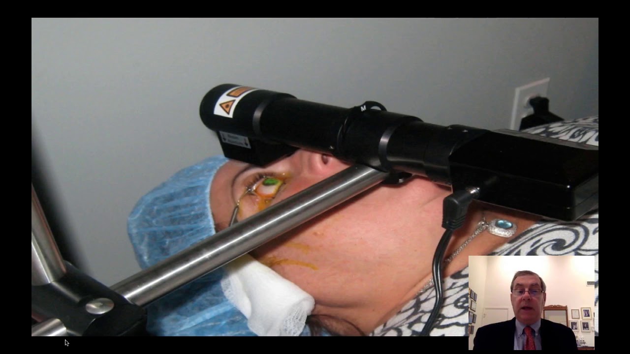 Corneal Crosslinking and Topographic Ablation - Dr. Eric Donnenfeld