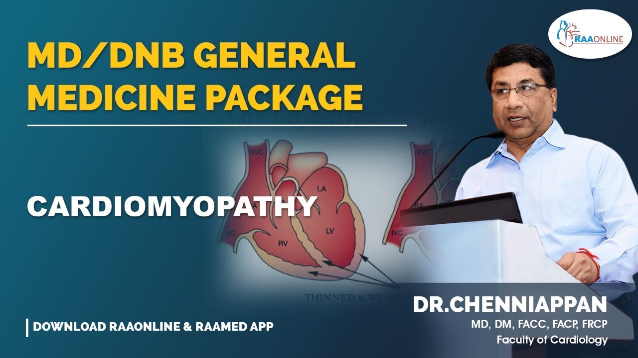 Cardiomyopathy - MD/DNB General Medicine