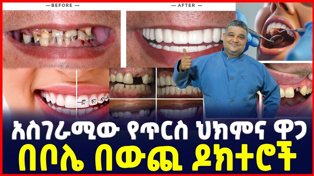 የጥርስ ህክምና ዋጋ  በ አዲስ  አበባ | Price of Teeth Treatment in Addis Ababa| Sile Business