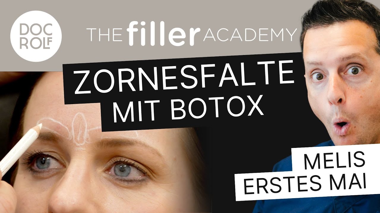BOTOX SPRITZEN LERNEN: Die ZORNESFALTE – TFA by doc.rolf