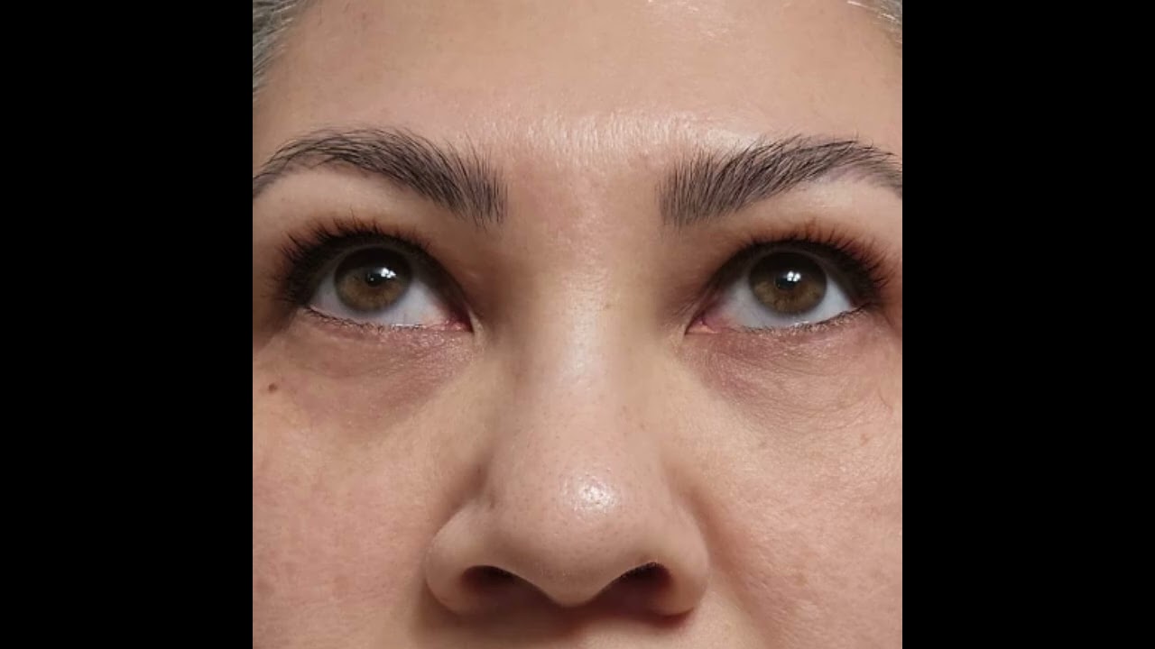 Latisse Medication for Growing Lashes Naturally &middot; Rancho Cucamonga, Inland Empire