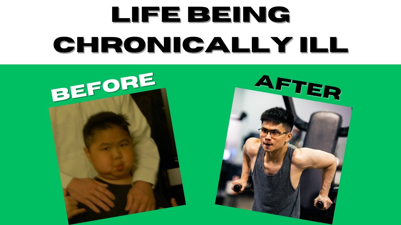 My Chronic Illness Story - Living with Kidney Transplant, UC, and Glaucoma