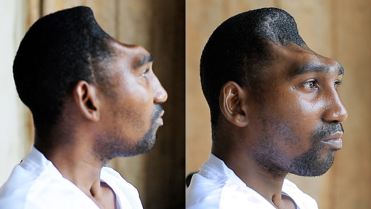 Никто не верит, что этот человек всё ещё жив | Они думали, что он умер, но всё кончено: ОН ПЕРЕЖИ...