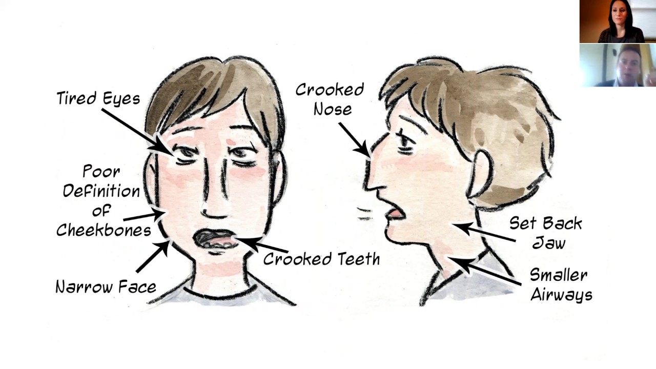 ADHD and Mouth Breathing