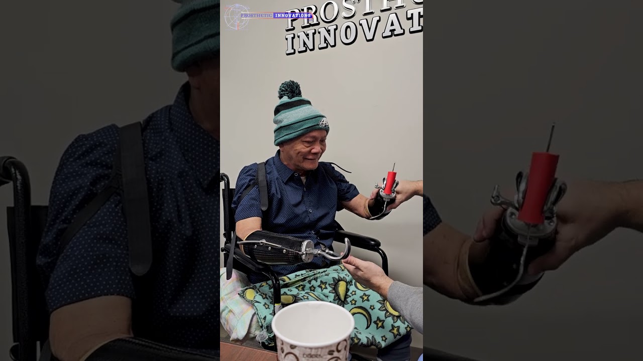 Bilateral Trans-Radial Body Powered Prosthetic User | Prosthetic Innovations