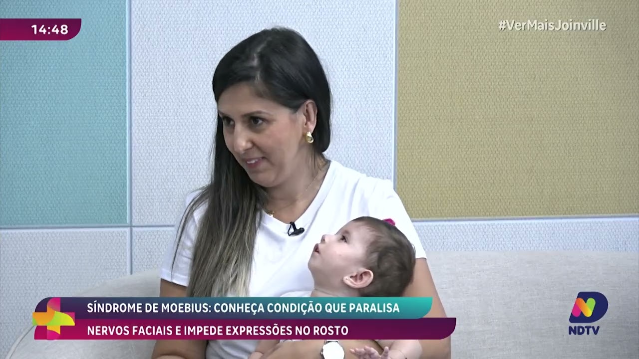Síndrome de Moebius: diagnóstico, desafios e inclusão na vida real