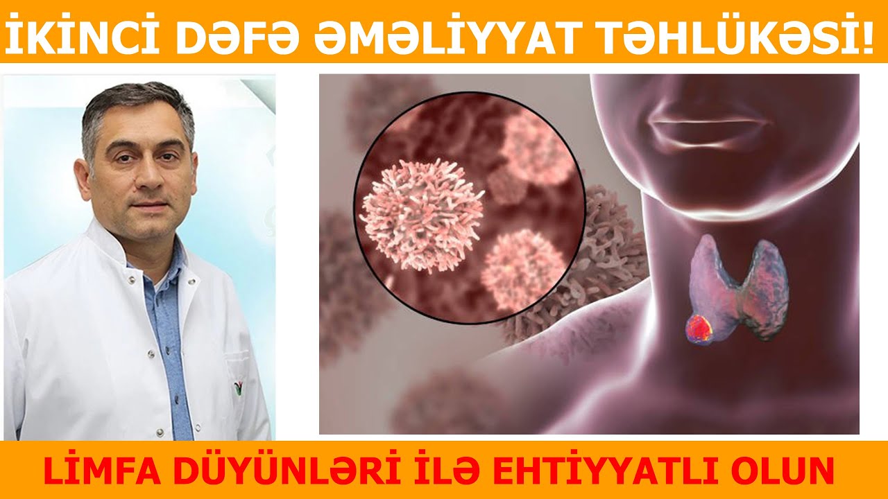Əməliyyatdan sonra yaranan limfalar qorxuludurlarmı? Dr.Sadiq Bəbirov