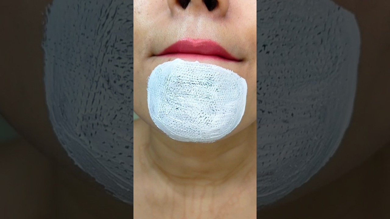 easy way to remove chin Whitehead & blackhead at home remedy&hearts;️#shorts #youtubeshorts #trendinghacks
