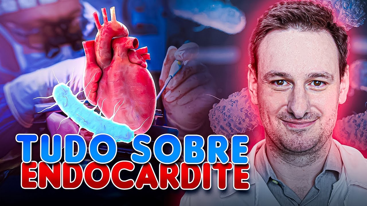 TUDO SOBRE ENDOCARDITE! CRIT&Eacute;RIOS DE DUKE ATUALIZADOS 2023