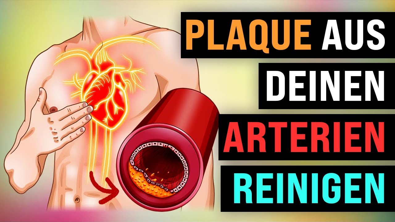 5 Wege, um PLAQUE aus den ARTERIEN zu entfernen