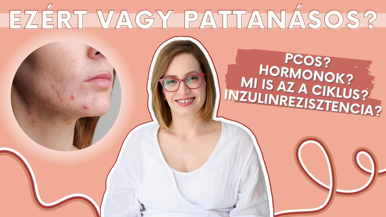 TI KÉRDEZTÉTEK, Ildi válaszol: milyen betegségek okoznak PATTANÁSOKAT?