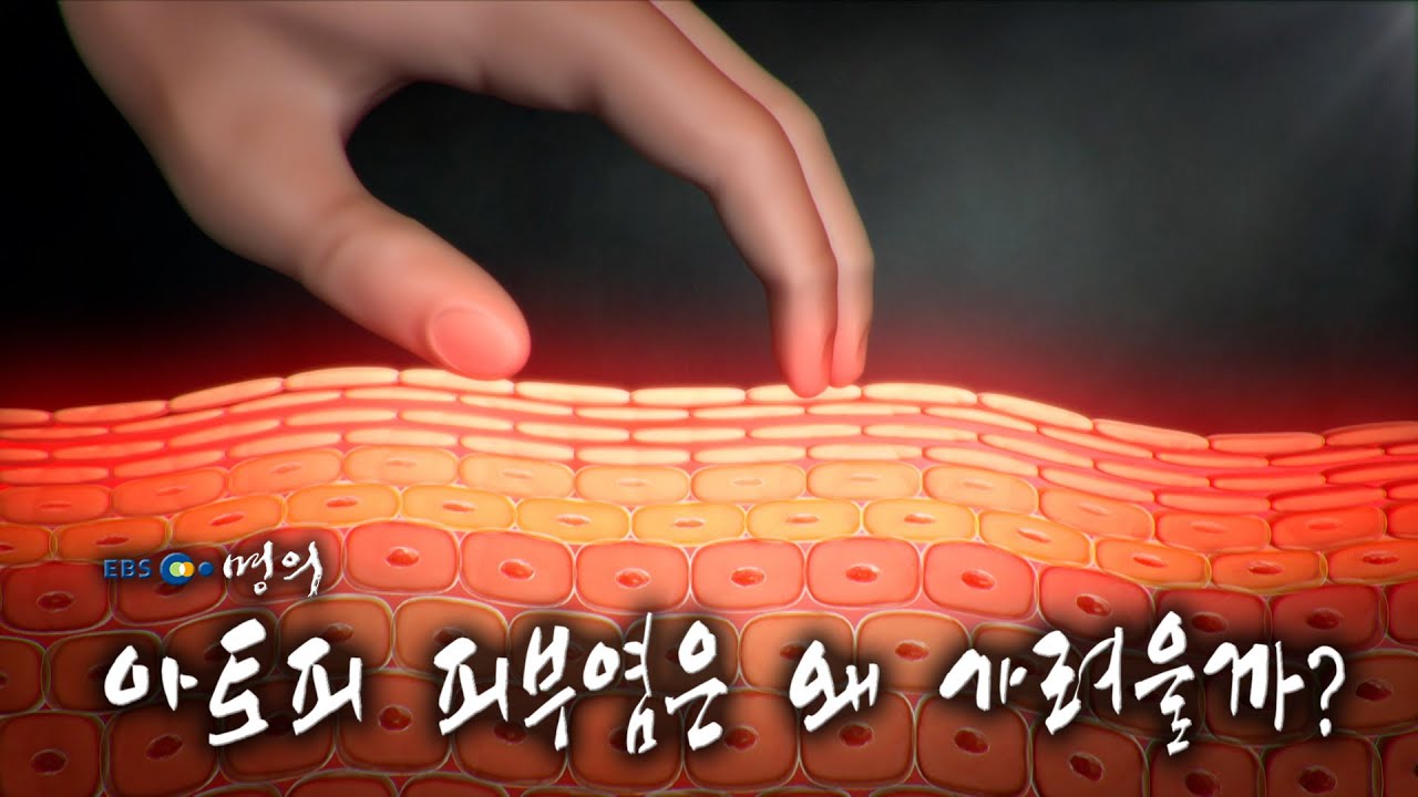 [명의 의학백과📖] 아토피 피부염은 왜 가려울까?