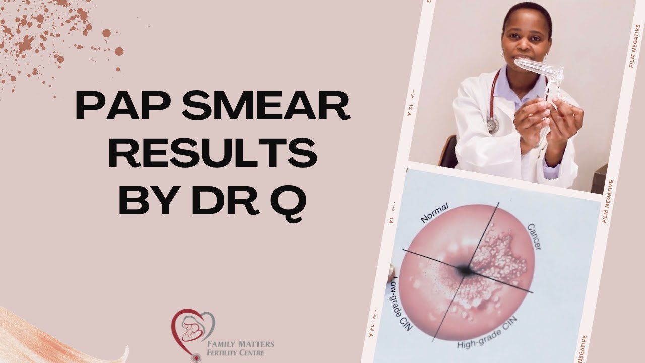 Explaining Pap Smear Results