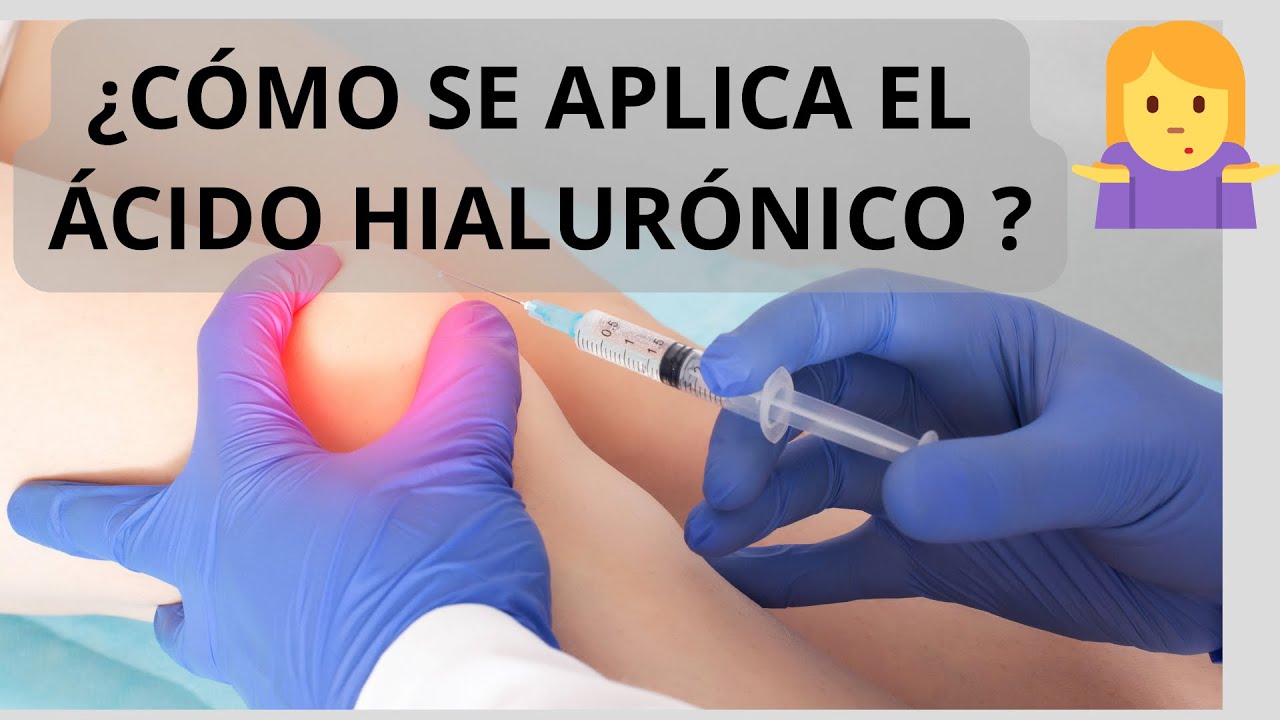 ¿CÓMO SE COLOCA EL ÁCIDO HIALURÓNICO EN LA RODILLA?