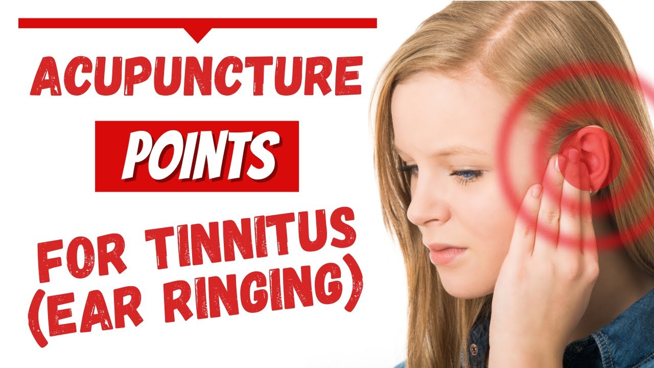 Acupuncture For Tinnitus (Ear Ringing) #acupuncturefortinnitus