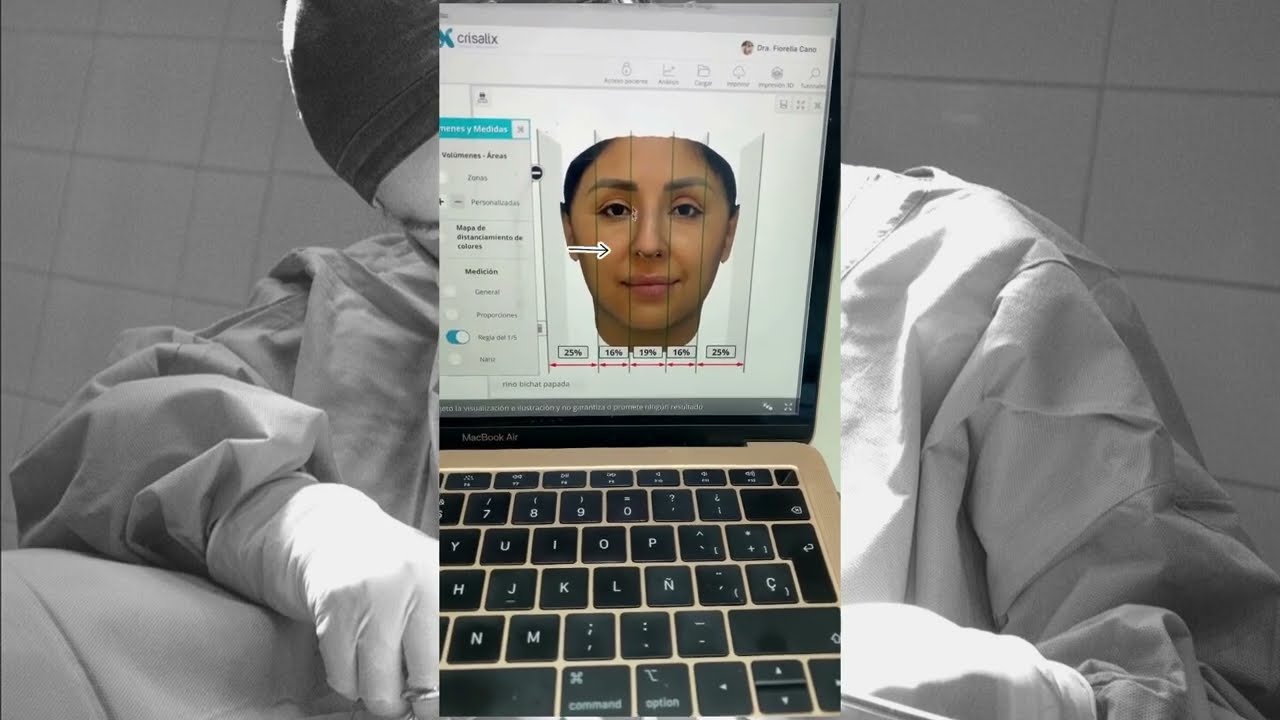 Simulación 3D Paciente - Crisalix