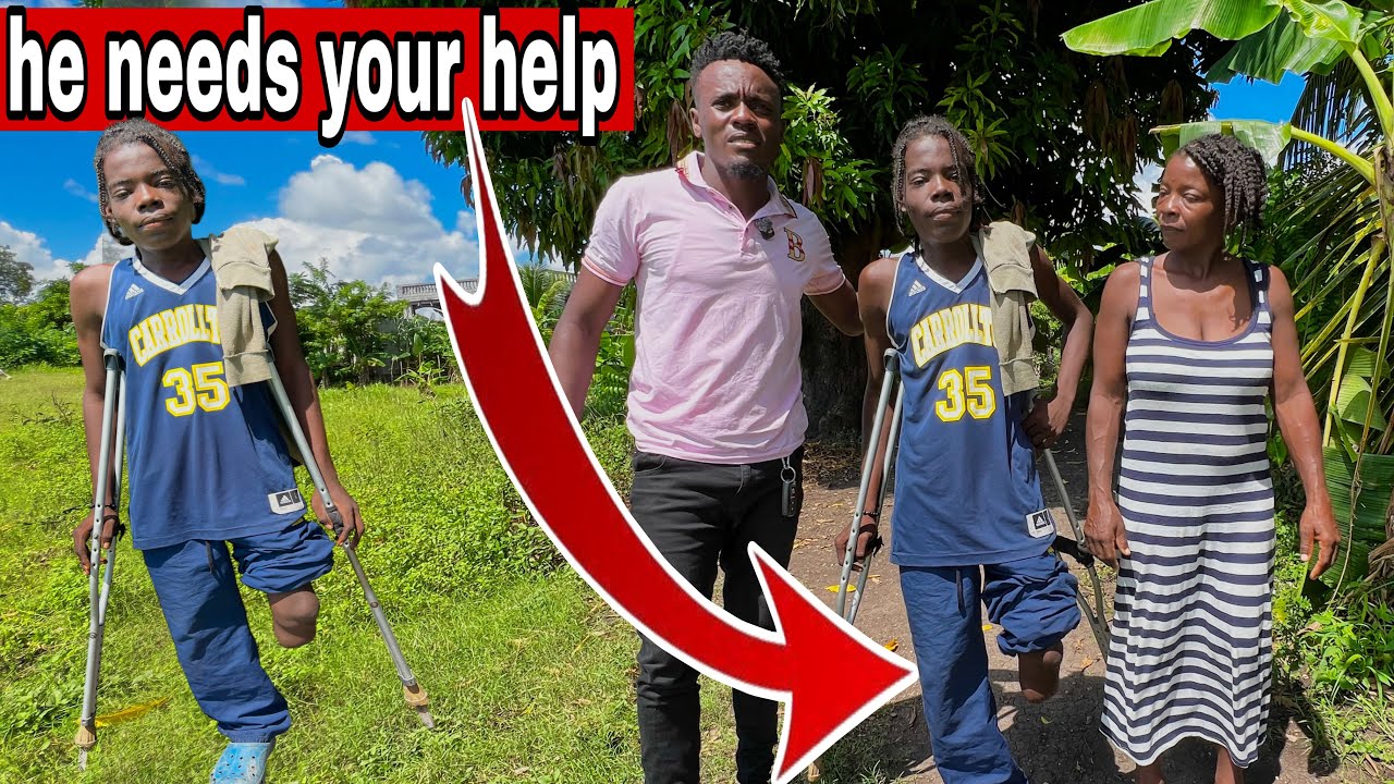 Gade sitiyasyon yon tijèn gason kap viv ak yon bout pye en Ayiti
