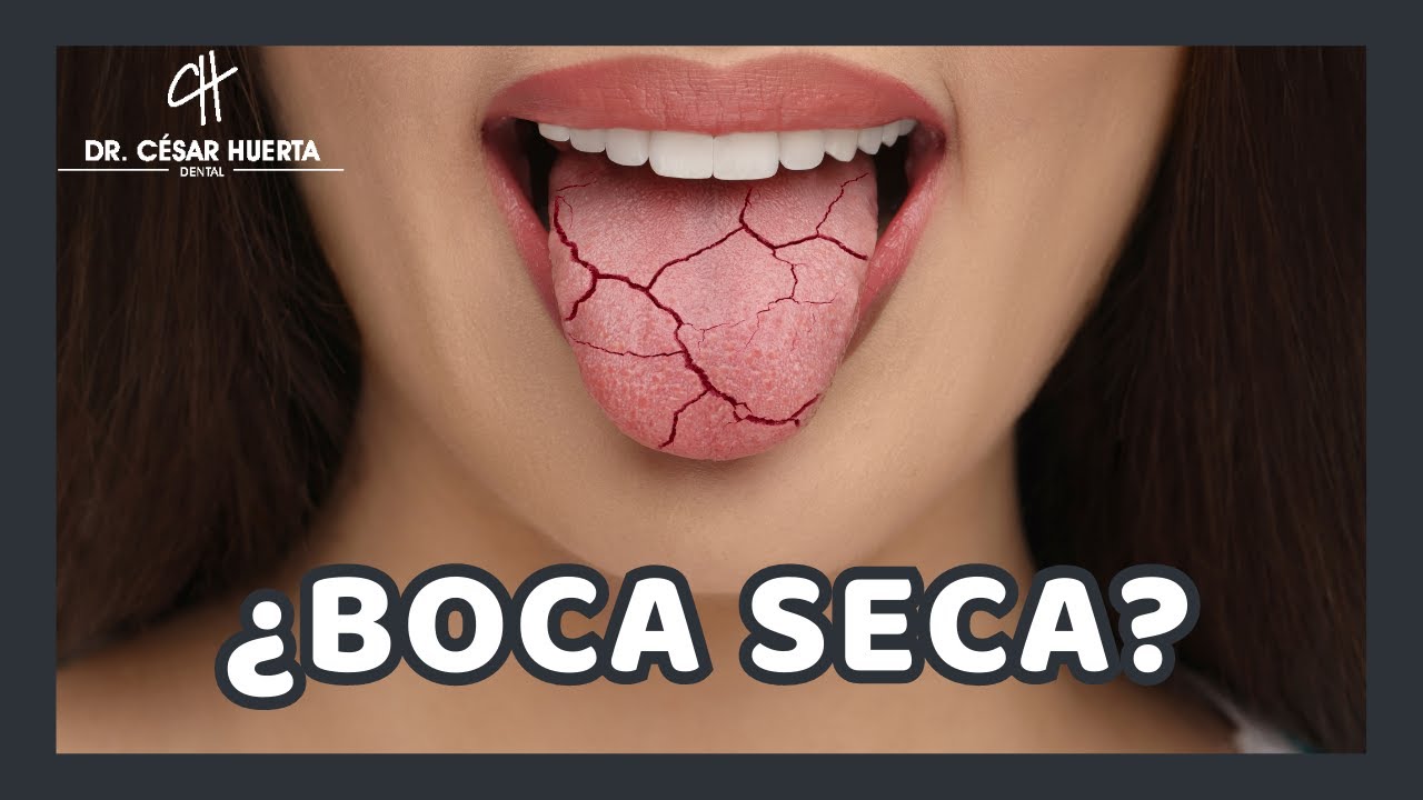 Boca seca ¿A qué se debe?. Hablemos de la Xerostomía