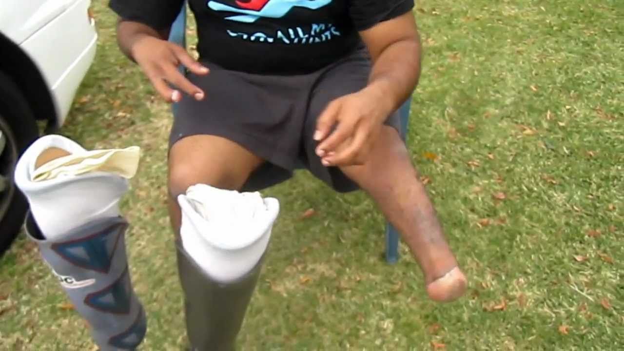 Double Amputee Dwayne - Stumps walking on concrete