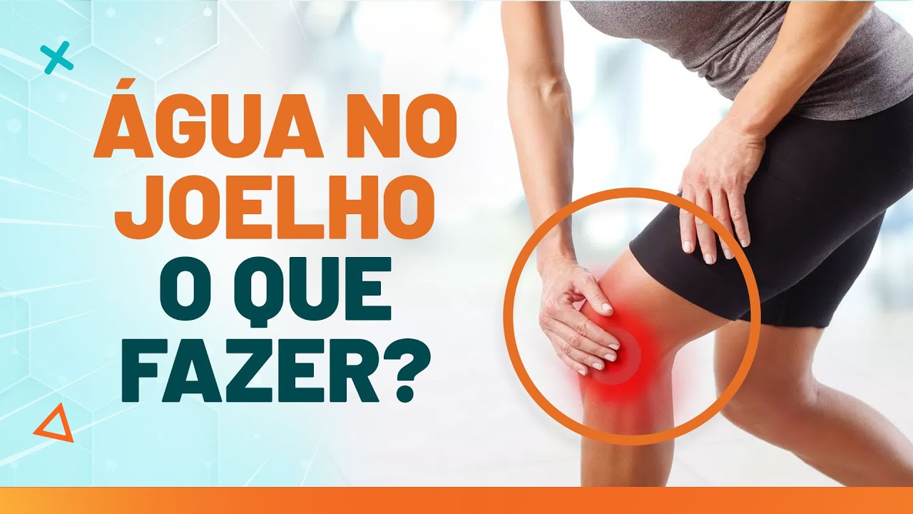 O QUE É DERRAME ARTICULAR NO JOELHO? - Fisioprev