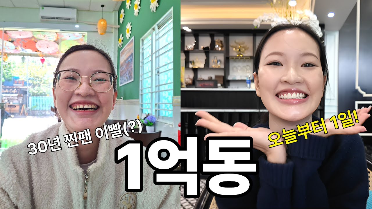 고생 많은 베트남 아내 타오에게 30년 된 이빨 보내주고 새 미소를 선물했습니다 (feat. 라미네이트)