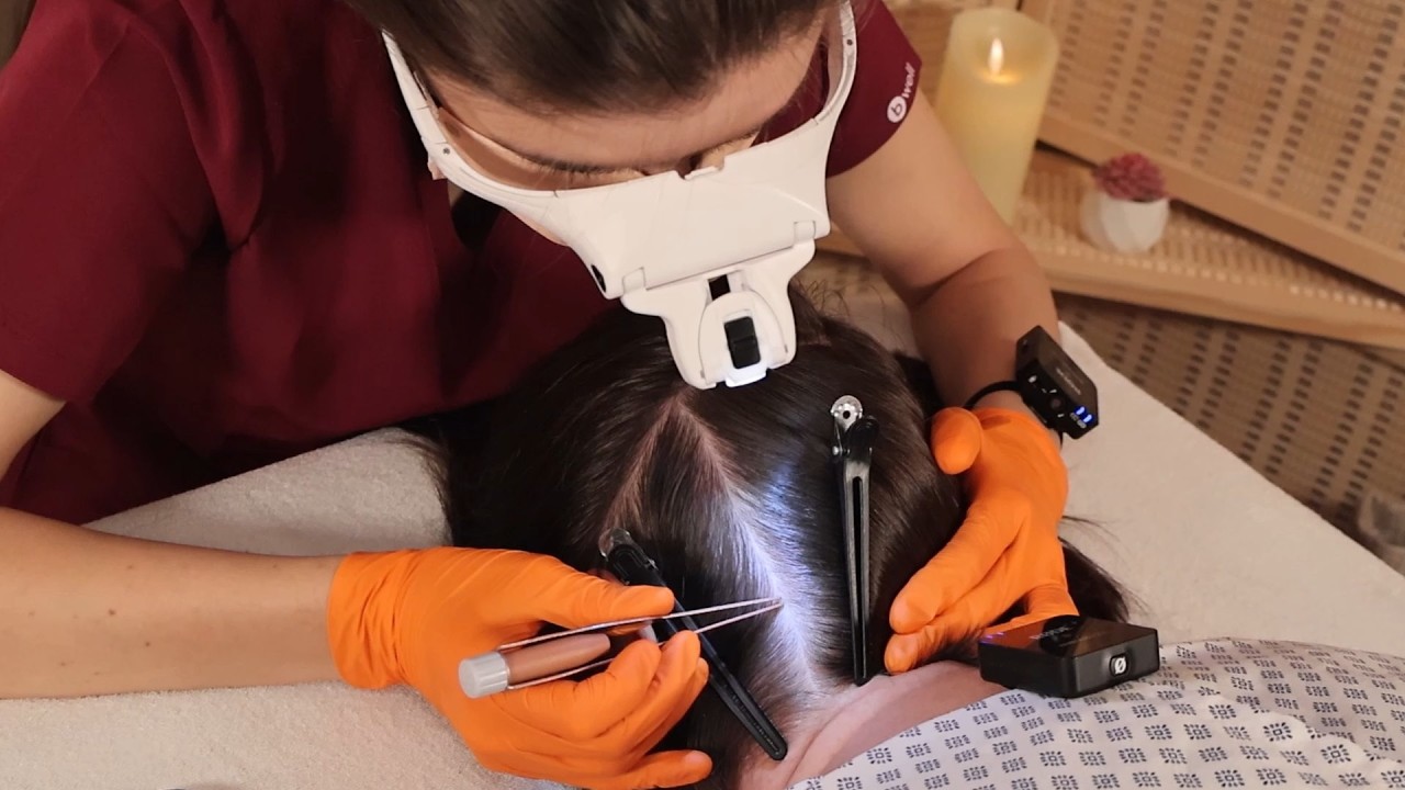 ASMR School Nurse LICE Check on Scalp and Neck | Lice Removal with a Comb and Tweezers