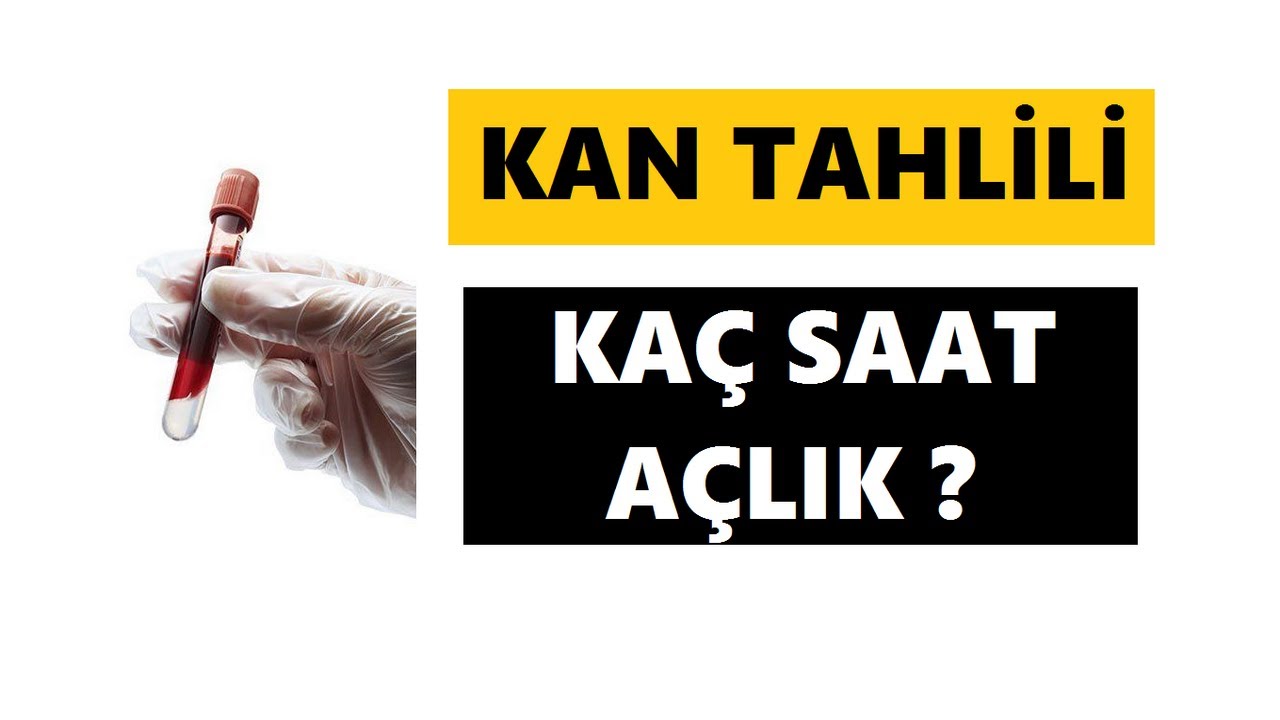 KAN TAHLİLİ İ&Ccedil;İN KA&Ccedil; SAAT A&Ccedil; KALMAK GEREKİR ?
