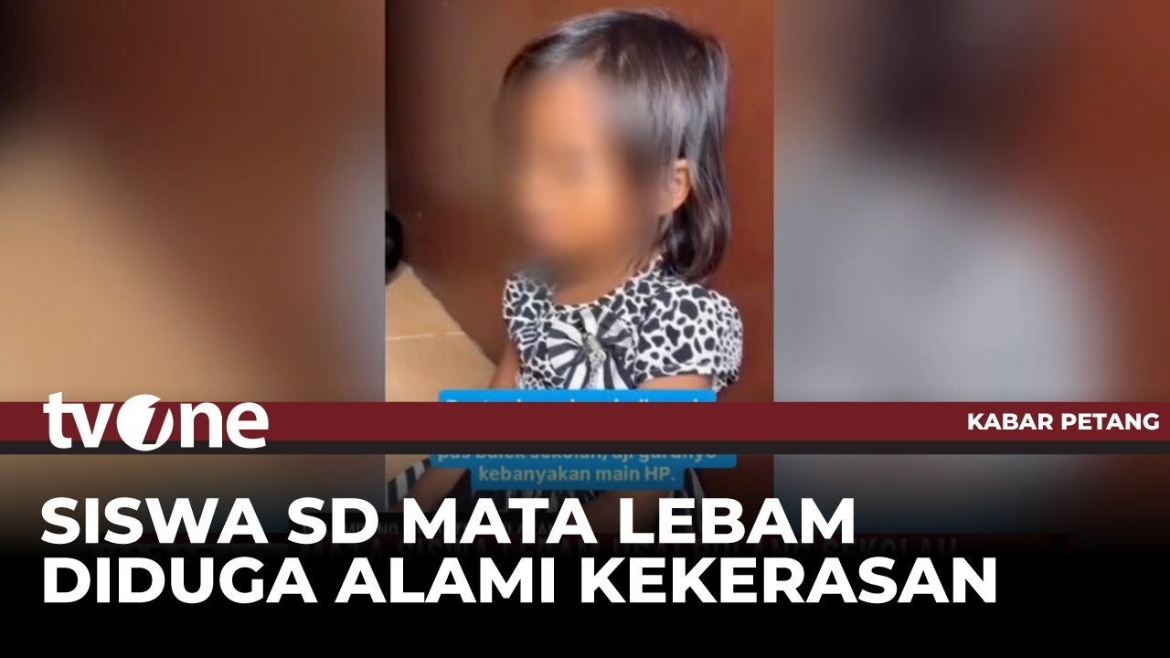 Mata Siswi di Palembang Lebam Usai Pulang Sekolah | tvOne