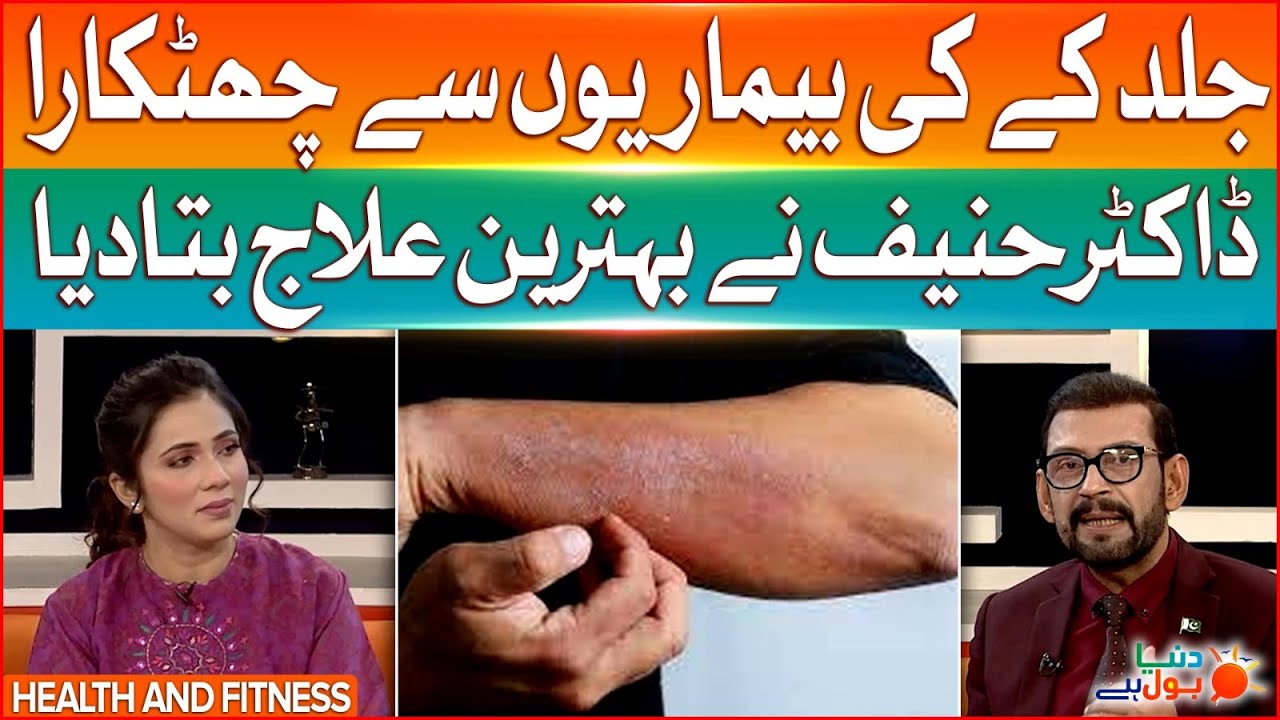 Skin Disease Easy Treatment | Home Remedies | Dr Hanif Exclusive Interview | Dunya BOL Hai