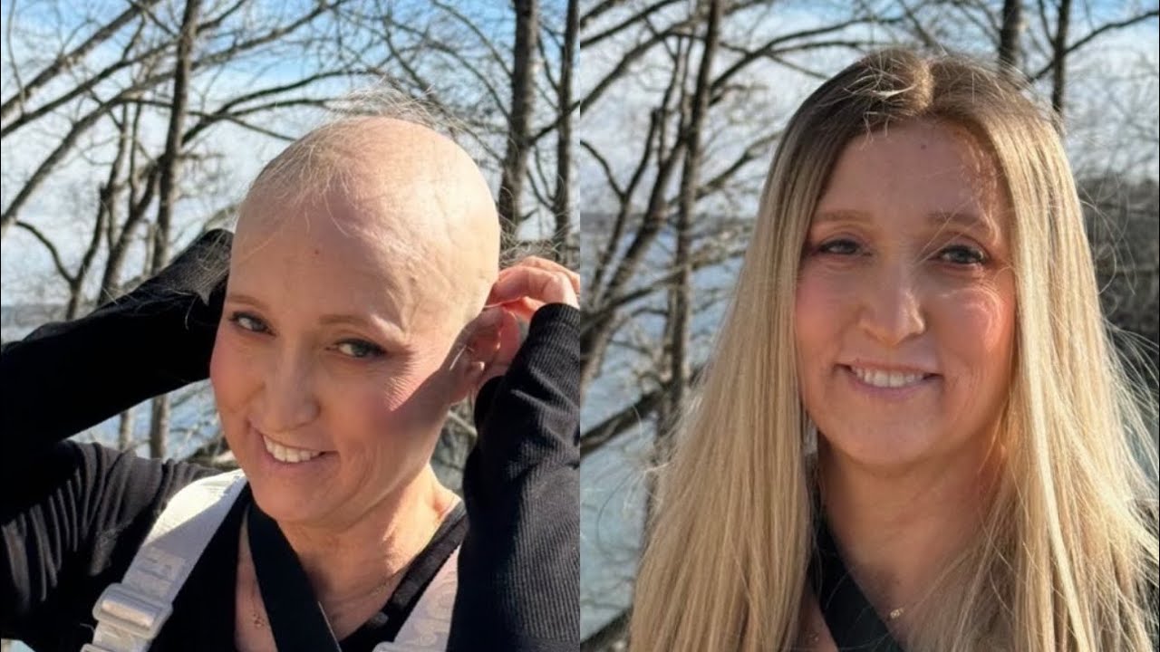 9 Months HAIR GROWTH Post Chemo