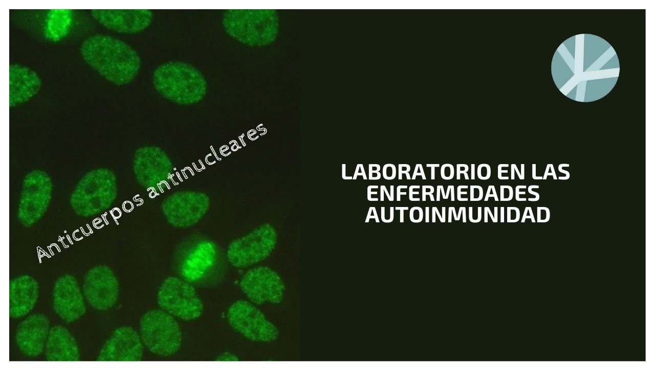 Anticuerpos antinucleares (ANA)