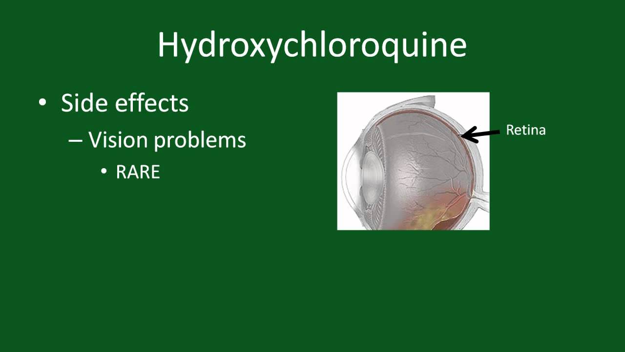 Hydroxychloroquine for Rheumatoid Arthritis