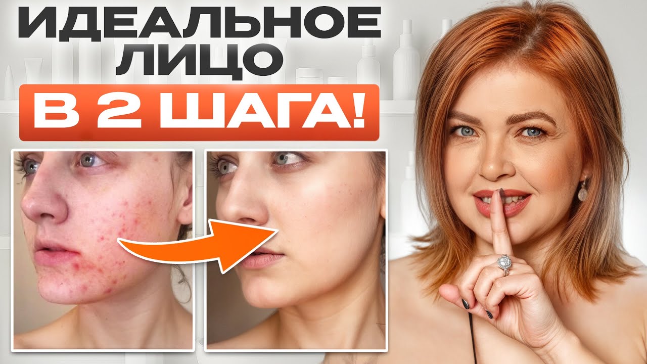 Акне уйдет НАВСЕГДА, если сделать ЭТО! Как избавиться от любых высыпаний?
