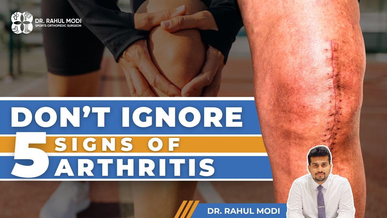 5 Signs of Arthritis you should know | Dr. Rahul Modi | Orthopedic surgeon | Goregaon west