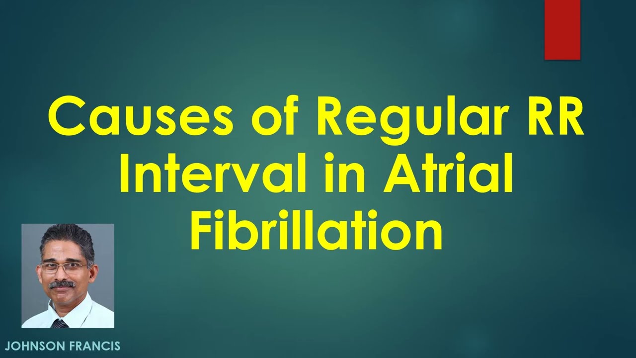 Causes of Regular RR Interval in Atrial Fibrillation