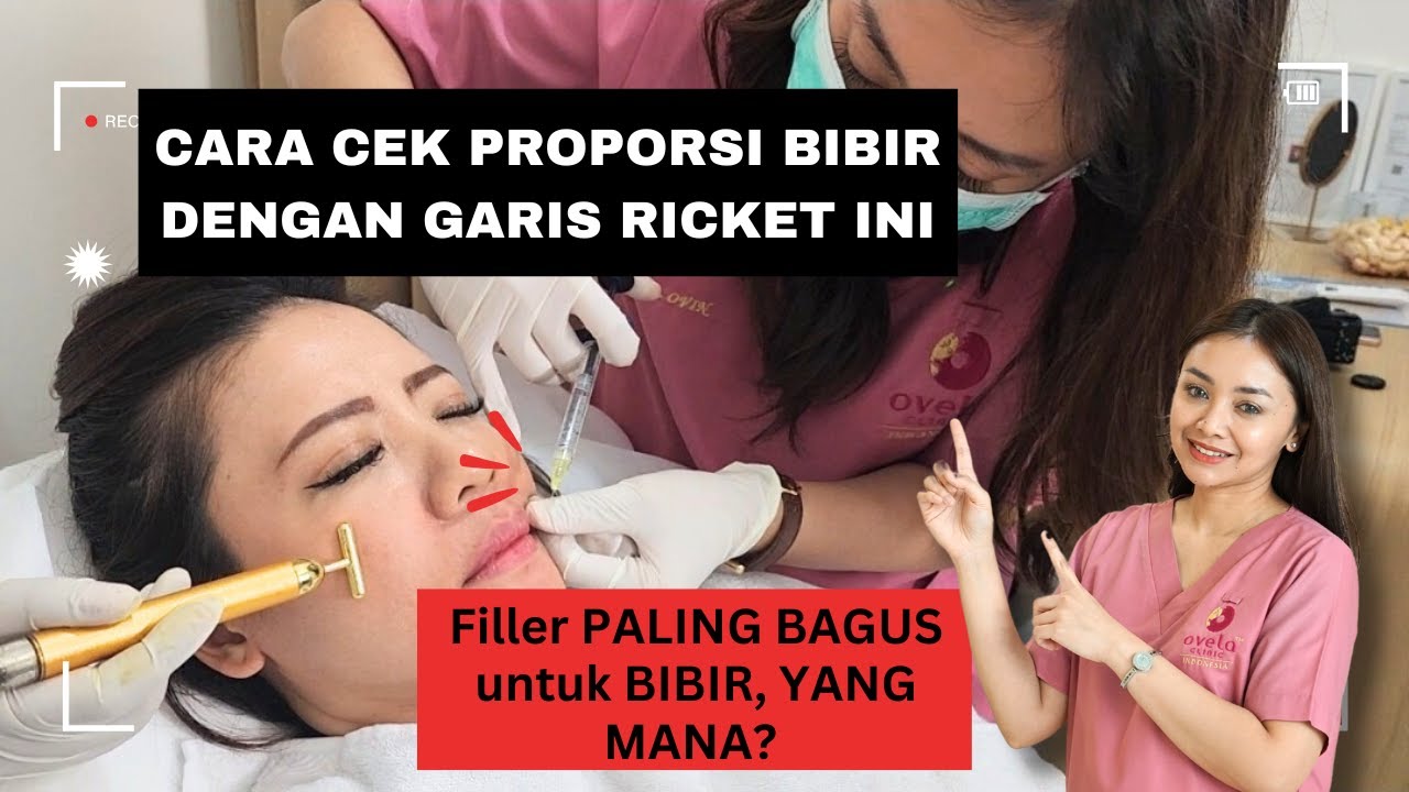 FILLER BIBIR Before After (2025) Hasil Instan - Lip Filler English Subtitled