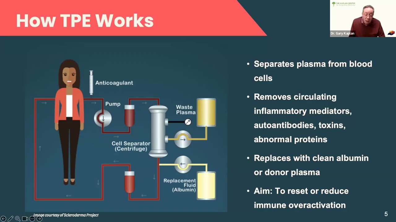 TPE / Therapeutic Plasma Exchange - Let's Talk Webinar, Immune System Series