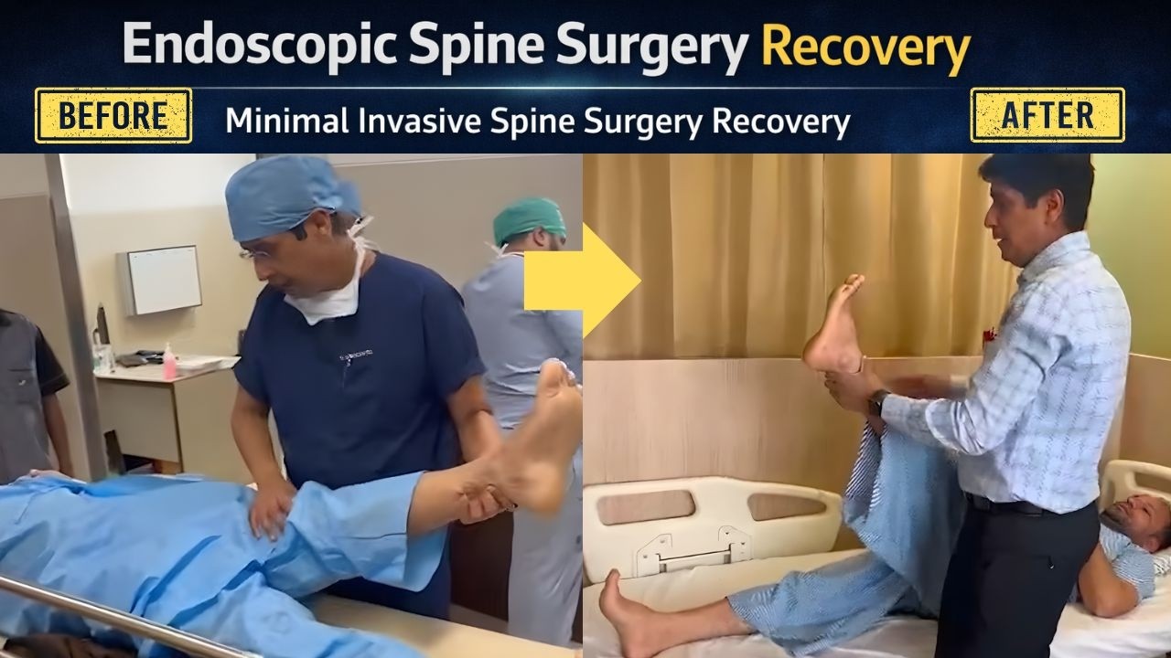 Endoscopic Spine Surgery Recovery | Minimal Invasive Spine Surgery Recovery | Dr. Ajay Kothari