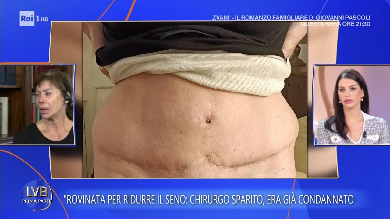 Aldina, truffata e rovinata dal chirurgo estetico - La volta buona 13/01/2026