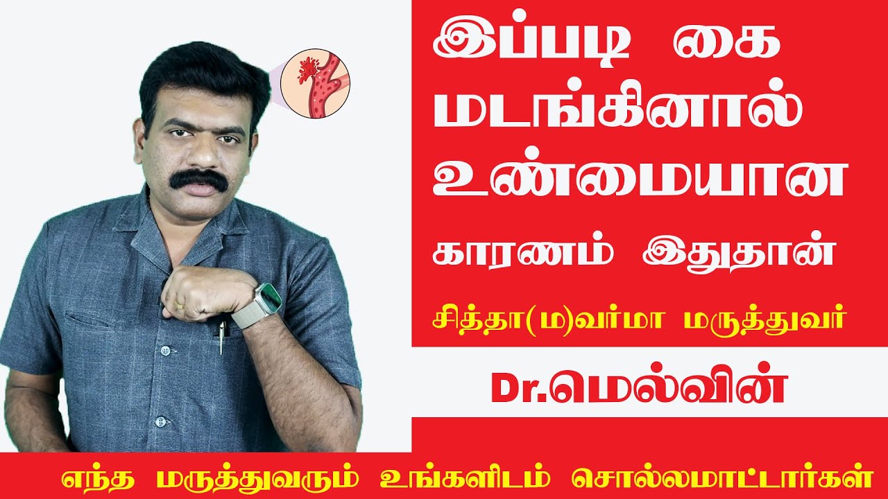 Stroke Siddha Treatment | இதுபற்றி உங்களுக்கு தெரியுமா